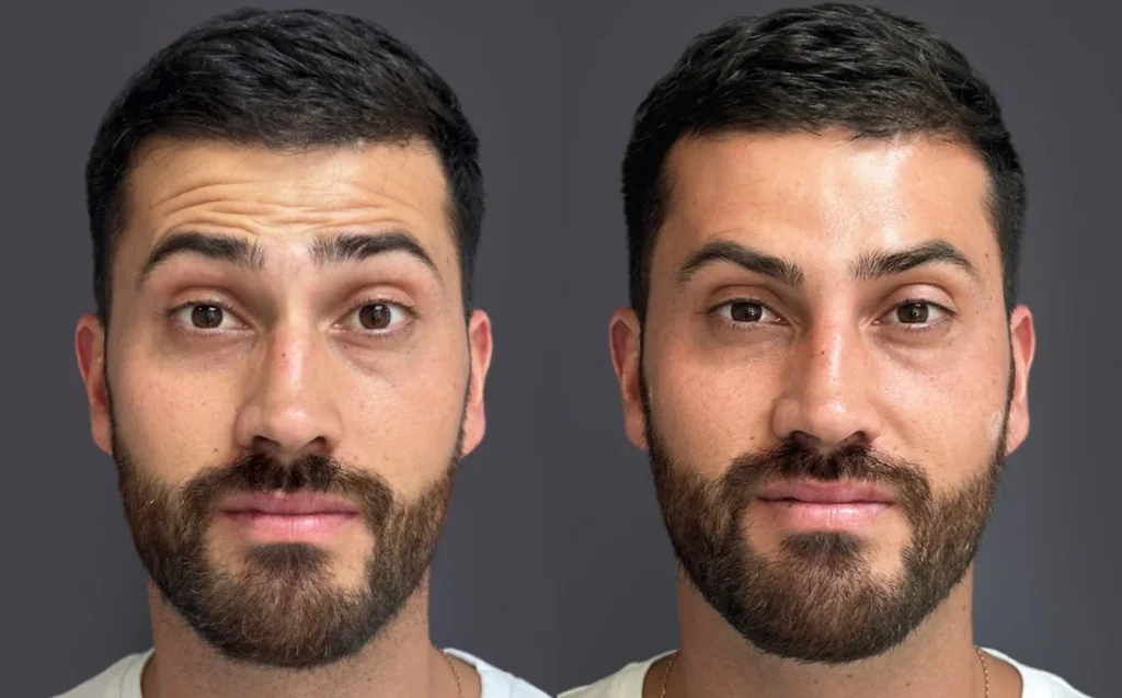 Tratamiento estetico facial con la Dra. Gaby Machado Cuenca